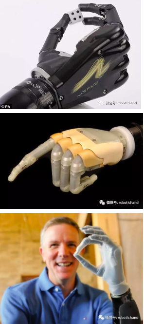 智能假肢:生肌电控制机器人手臂