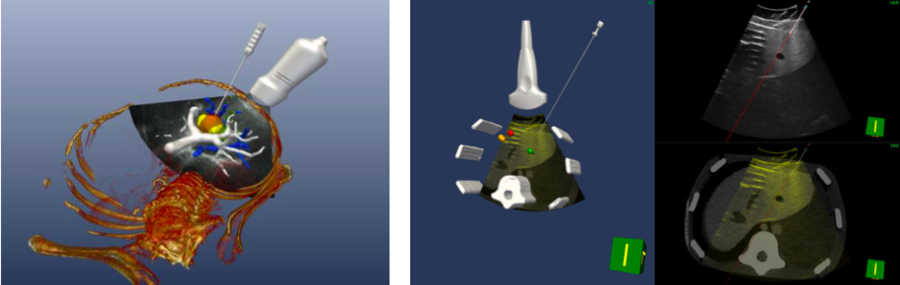 三维手术导航系统术前规划.png 三维手术导航系统术前规划.png